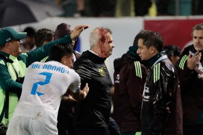 Javier Aguirre sustained a head injury after he was hit by a can thrown from the stands.