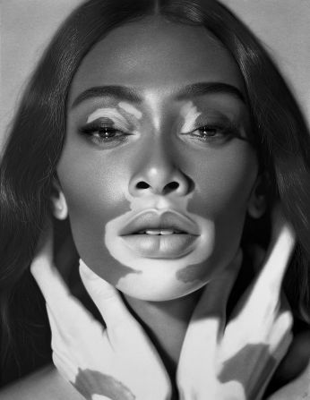 With his new exhibition “Drawing Awareness,” acclaimed British Nigerian hyperrealist artist Kelvin Okafor aims to celebrate different skin conditions. The inspiration for came from his 2019 portrait of fashion model Winnie Harlow, who has the skin condition vitiligo. Look through the gallery to see more.